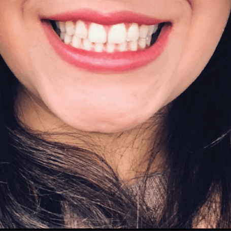 Brush your teeth using <br> Activated Charcoal <p></p>